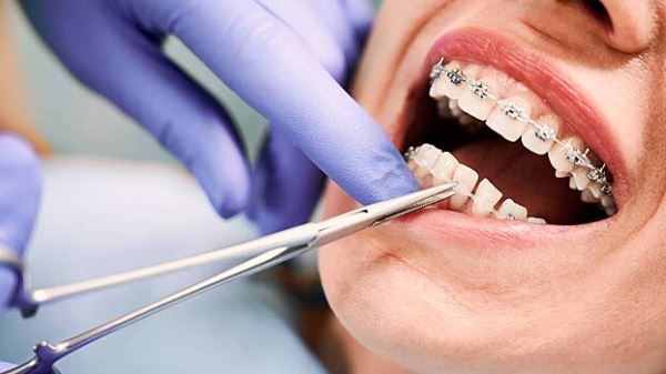 Стоматолог Суджаев объяснил, почему неправильный прикус опасен для здоровья